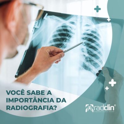 Radclin