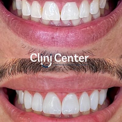 Clini Center